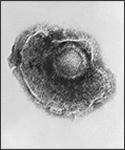 Electron micrograph of a Varicella (Chickenpox) Virus.