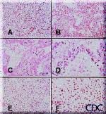 Composite photo of histology slides.