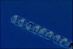 Thumbnail showing plankton