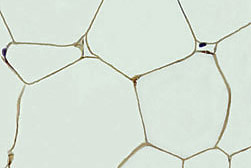 Microphoto of cross-section of fat tissue from a mouse, showing perilipin protein as brown borders of cells. Link to photo information