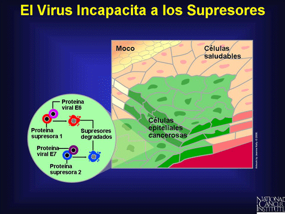 El Virus Incapacita a los Supresores