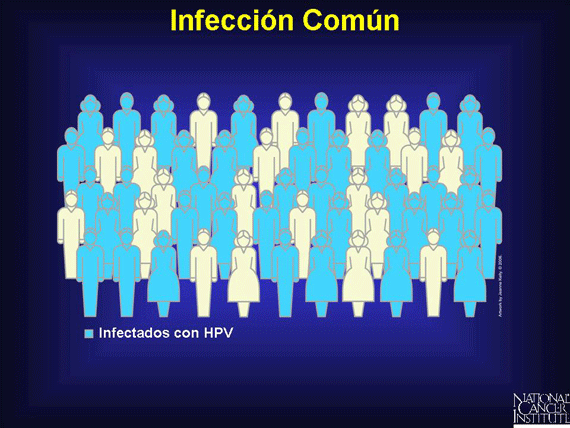 Infección Común