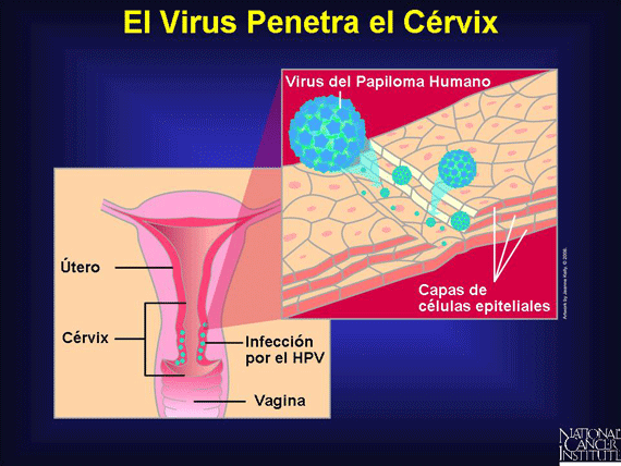 El Virus Penetra el Cérvix