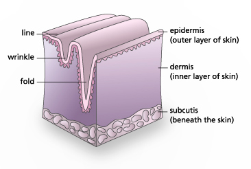 diagram showing formation of wrinkle in the skin