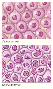 Células normal y anormal