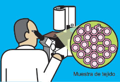 El patólogo usa un microscopio para examinar los tejidos.