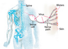 The spine and nerve paths - Click to enlarge in new window.