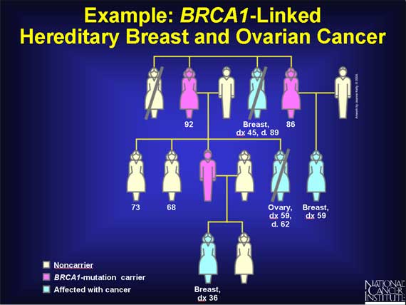 Example: <i>BRCA1</i>-Linked Hereditary Breast and Ovarian Cancer