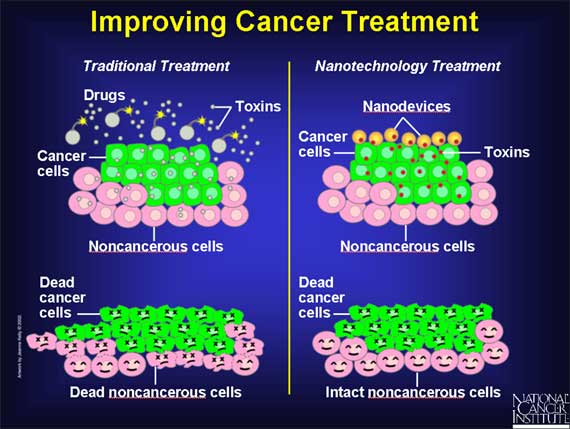Improving Cancer Treatment