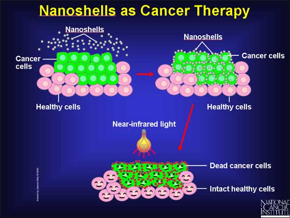 Nanoshells as Cancer Therapy