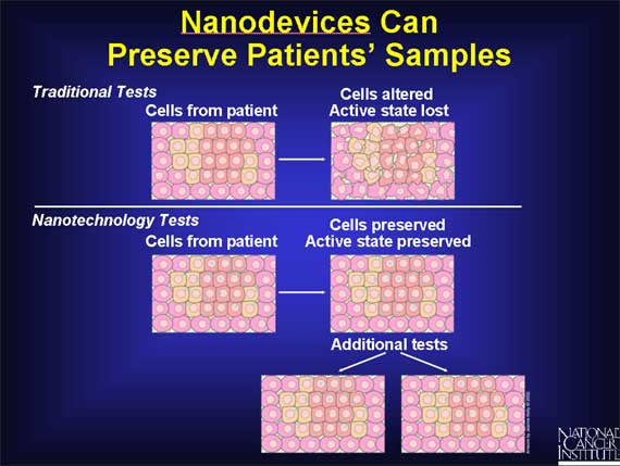 Nanodevices Can Preserve Patients' Samples