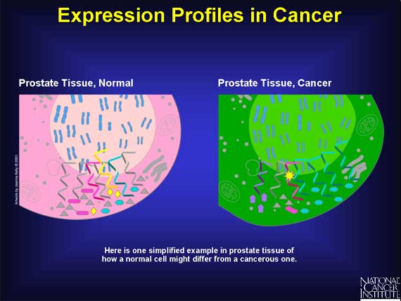 Expression Profiles in Cancer
