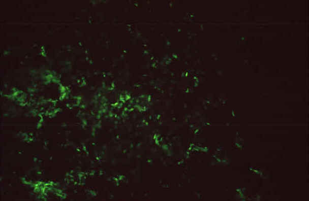 Picture-Indirect immunofluorescence assay reaction of a positive human serum on Rickettsii grown in chicken yolk sacs