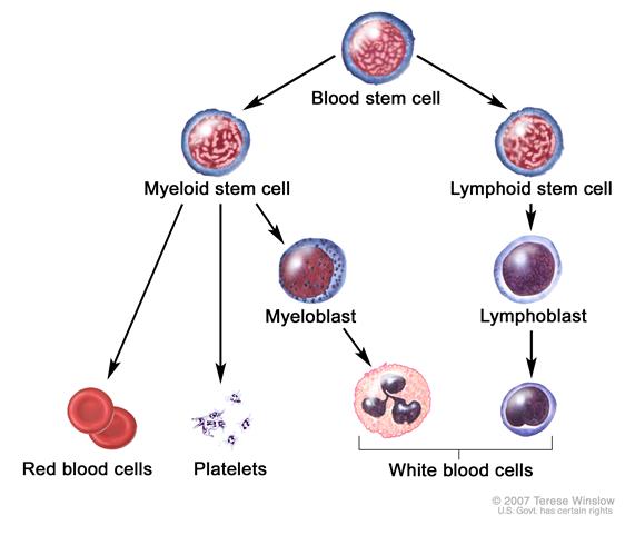Blood cell development; drawing shows the steps a blood stem cell goes through to become a red blood cell, platelet, or white blood cell.  Drawing shows a myeloid stem cell becoming a red blood cell, platelet, or myeloblast, which then becomes a white blood cell. Drawing also shows a lymphoid stem cell becoming a lymphoblast and then one of several different types of white blood cells.