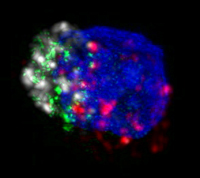 HIV-specific killer T cell with perforin in green.