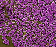 methicillin-resistant Staphylococcus aureus bacteria