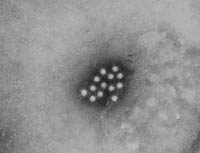 An electron micrograph of the hepatitis A virus (HAV)