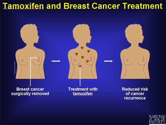 Tamoxifen and Breast Cancer Treatment