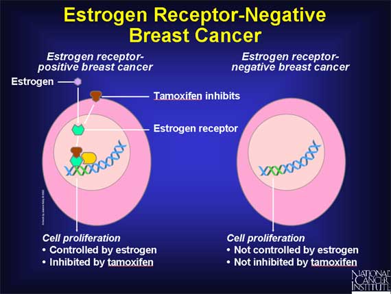 Estrogen Receptor-Negative Breast Cancer