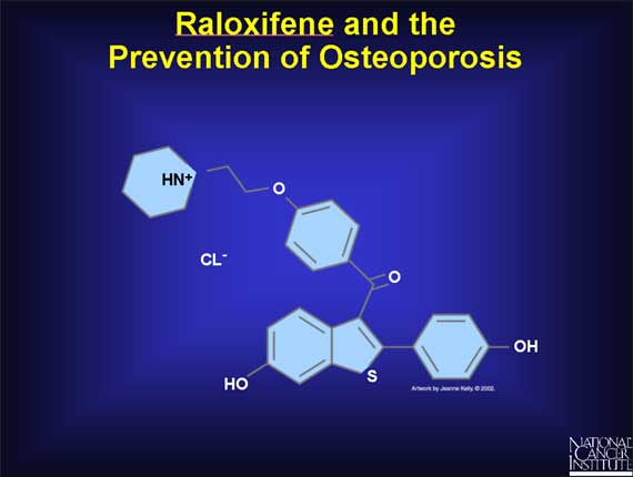 Raloxifene and the Prevention of Osteoporosis