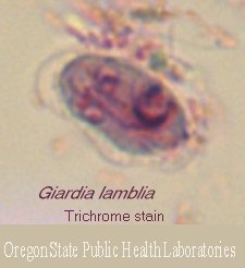 Trichrome cyst - Giardia lamblia