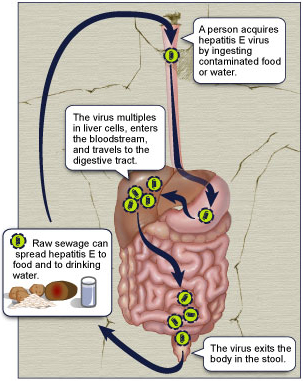 Hepatitis E Virus Infection Illustration