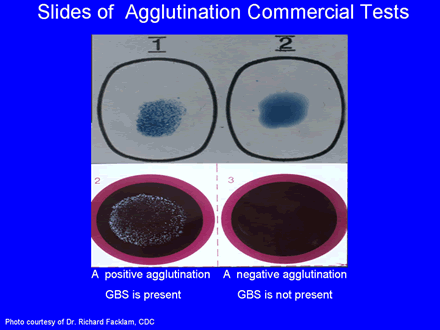 Slides of Agglutination Commercial Tests