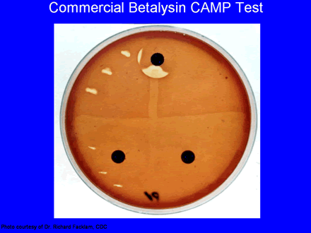 Commercial Betalysin CAMP Test