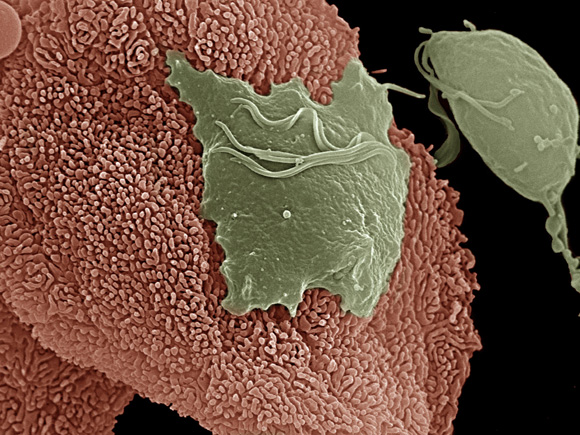 Photo of T. Vaginalis Parasite