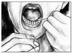Drawing showing a woman’s mouth as she flosses her lower front teeth.