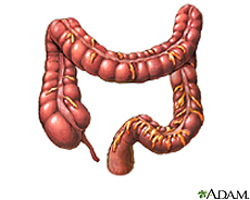 Ilustración del intestino grueso