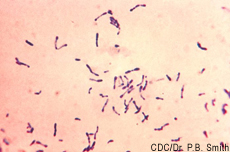 Fotografía de la bacteria que causa la difteria