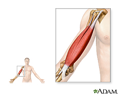 Ilustración de músculos del brazo