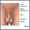 Reparación quirúrgica de la torsión testicular - Serie