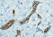 GSTP in human liver bile duct photograph