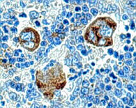  Rauscher leukemia virus p30 in megakaryocytes of mouse spleen. Formalin.  photograph.