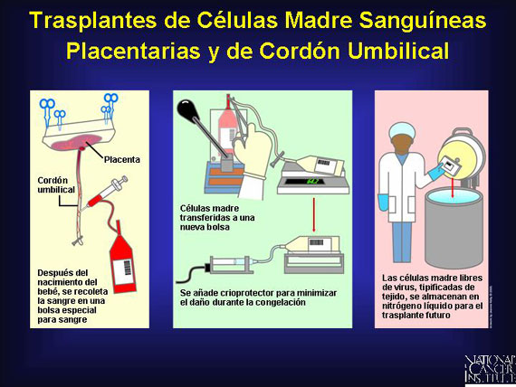 Trasplantes de Células Madre Sanguíneas Placentarias y de Cordón Umbilical