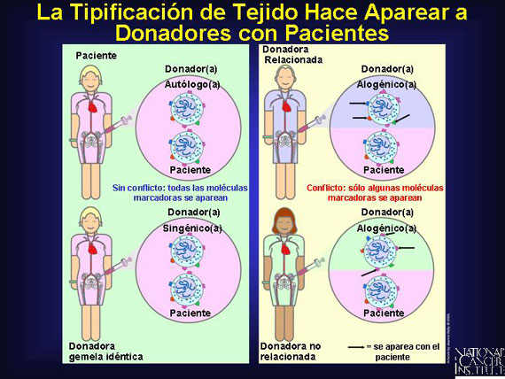 La Tipificación de Tejido Hace Aparear a Donadores con Pacientes