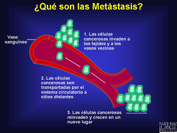 ¿Qué son las Metástasis?