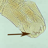 barbs in the mouth of a hookworm