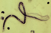 Microfilaria of Wuchereria bancrofti