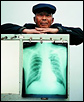 Man behind chest X-ray