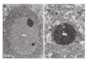 Figure 5. Electron micrograph of organotypic cultures shows typical nuclear condensation, which characterizes the advanced apoptotic neurodegeneration resulting from PCP treatment. (23325 bytes)