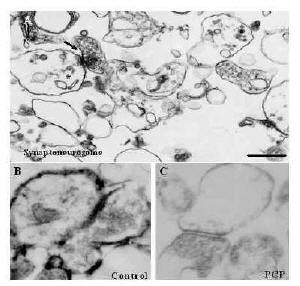 Figure 6. Electron micrograph of the synaptoneurosomes prepared from the striatum-nucleus accumbens complex of the organotypic culture.