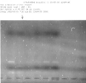 PCR Digest