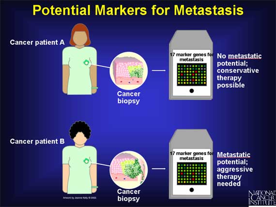 Potential Markers for Metastasis
