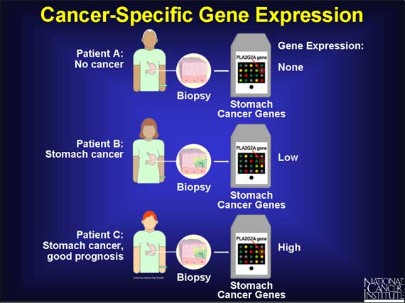 Cancer-Specific Gene Expression