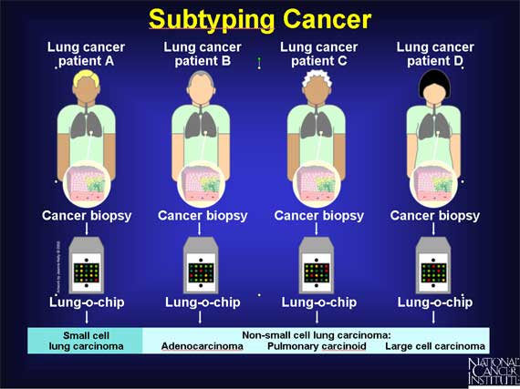 Subtyping Cancer