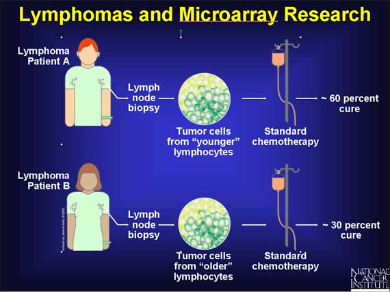 Lymphomas and Microarray Research