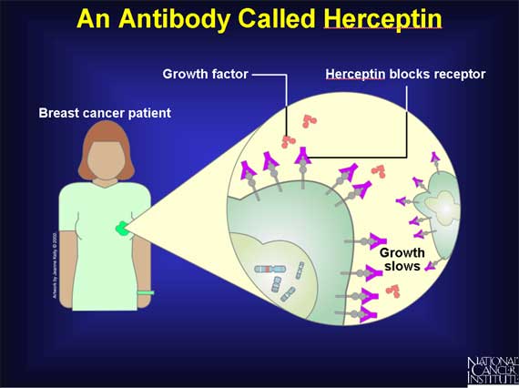 An Antibody Called Herceptin
